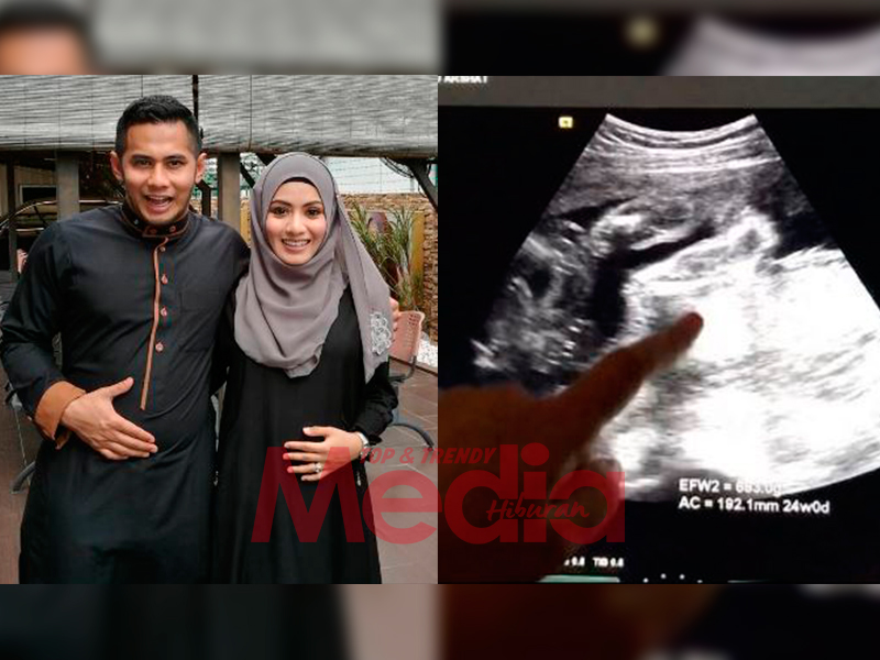 Fizo Dan Mawar Bakal Timang Anak Perempuan Media Hiburan